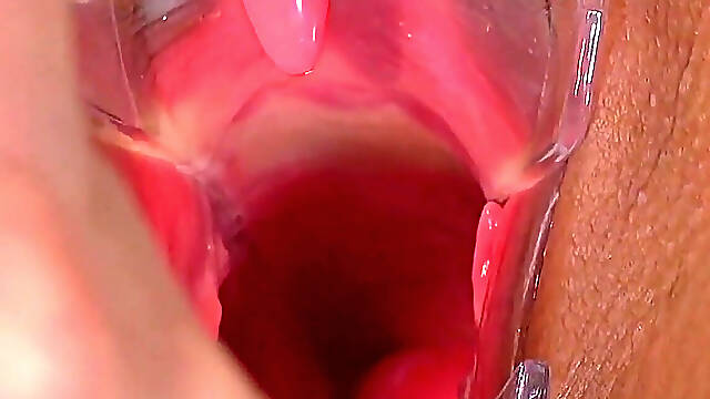 Cervical Screening of Big Busty Babe Barbara Bieber